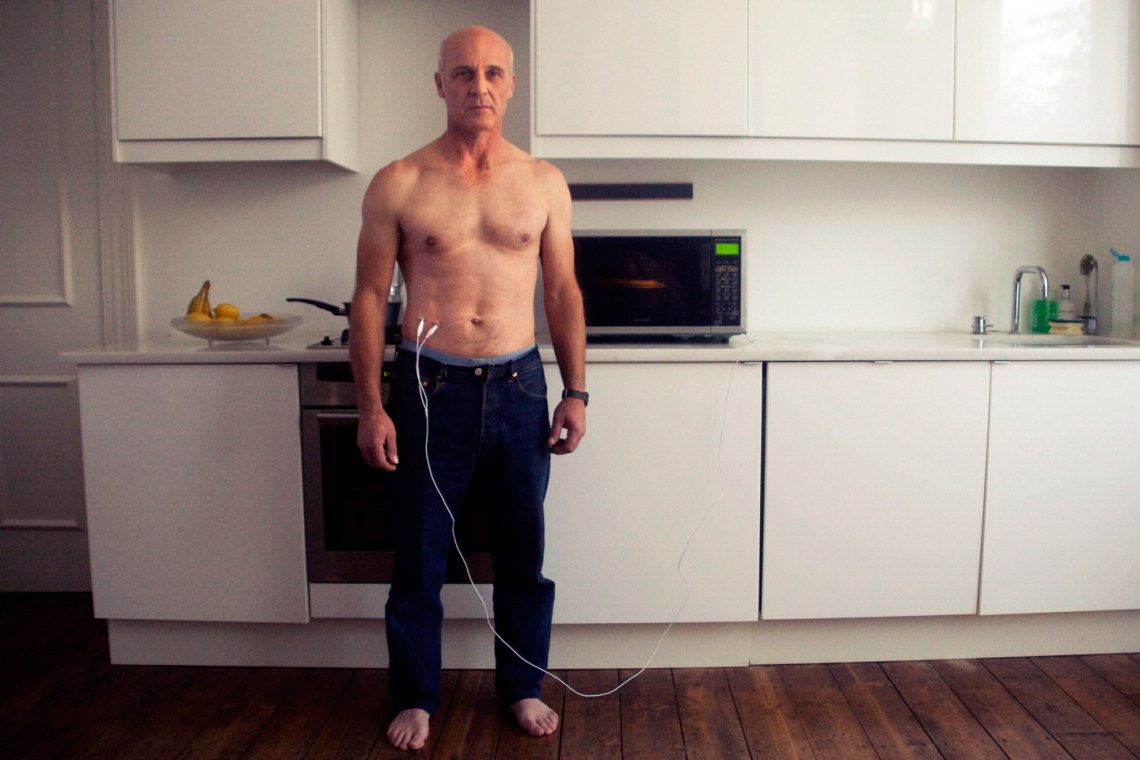 Electrocyte appendix